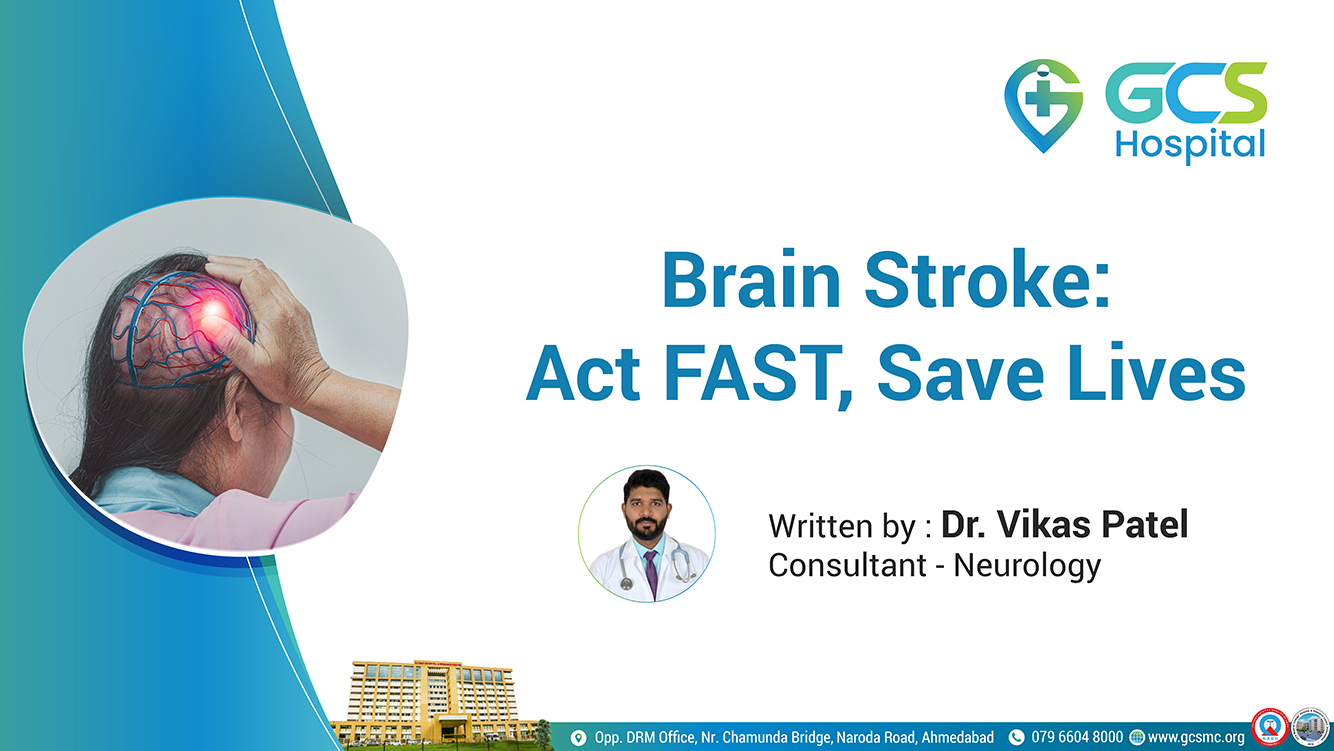 Brain Stroke: Act FAST, Save Lives